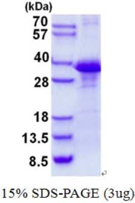 SDS-PAGE Recombinant Human CLNS1A His Protein