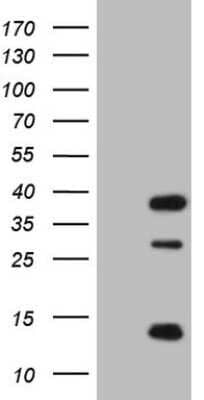 Western Blot: CLOCK Antibody (OTI2H7) - Azide and BSA Free [NBP2-71479] - Human recombinant protein fragment corresponding to amino acids 1-285 of human CLOCK (NP_004889) produced in E.coli.