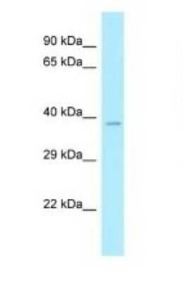 Western Blot: CLP1/HEAB Antibody [NBP1-98452] - Titration: 1.0 ug/ml Positive Control: RPMI-8226 Whole Cell.