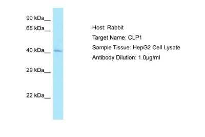 Western Blot: CLP1/HEAB Antibody [NBP1-98453] - Antibody Dilution: 1.0ug/ml Sample Tissue: HepG2 cell lysate.