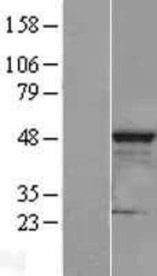 Western Blot: CLP1 Overexpression Lysate (Adult Normal) [NBL1-09277] Left-Empty vector transfected control cell lysate (HEK293 cell lysate); Right -Over-expression Lysate for CLP1.