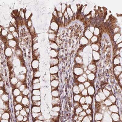 Immunohistochemistry CLPB Antibody