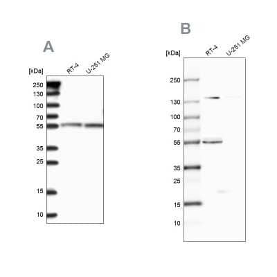 Western Blot CLPB Antibody