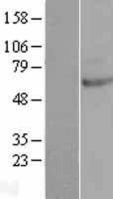 Western Blot CLPB Overexpression Lysate