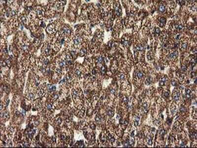 Immunohistochemistry-Paraffin: CLPP Antibody (1F6) [NBP2-03323] - Staining of paraffin-embedded Human liver tissue using anti-CLPP mouse monoclonal antibody.