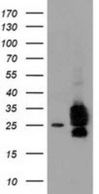 Western Blot: CLPP Antibody (1F6) [NBP2-03323] - HEK293T cells were transfected with the pCMV6-ENTRY control (Left lane) or pCMV6-ENTRY CLPP (Right lane) cDNA for 48 hrs and lysed. Equivalent amounts of cell lysates (5 ug per lane) were separated by SDS-PAGE and immunoblotted with anti-CLPP.