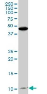 Western Blot: CLPS Antibody [H00001208-B01P] - Analysis of CLPS expression in human pancreas.