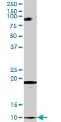 Western Blot: CLPS Antibody [H00001208-D01P] - Analysis of CLPS expression in human pancreas.