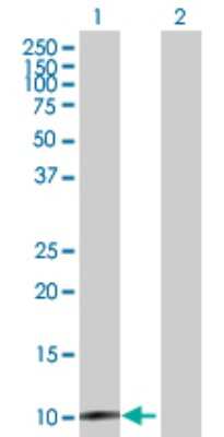 Western Blot: CLPS Antibody [H00001208-D01P] - Analysis of CLPS expression in transfected 293T cell line by CLPS polyclonal antibody.Lane 1: CLPS transfected lysate(12.00 KDa).Lane 2: Non-transfected lysate.