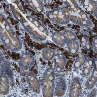 Immunohistochemistry-Paraffin CLPTM1L Antibody