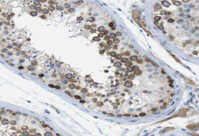 Immunohistochemistry-Paraffin: CLPTM1L Antibody [NBP1-84378] - Staining of human testis shows moderate to strong cytoplasmic positivity in cells in seminiferous ducts.