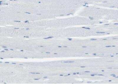 Immunohistochemistry-Paraffin: CLPTM1L Antibody [NBP1-84378] - Staining of human skeletal muscle shows no postivity in myocytes as expected.