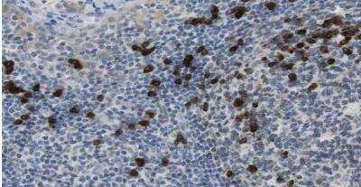 Immunohistochemistry-Paraffin: CLPTM1L Antibody [NBP1-84378] - Staining of human tonsil shows strong cytoplasmic postivity in non-germinal center cells. 