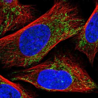 Immunocytochemistry/Immunofluorescence: CLPX Antibody [NBP1-89478] - Immunofluorescent staining of human cell line U-2 OS shows localization to mitochondria.