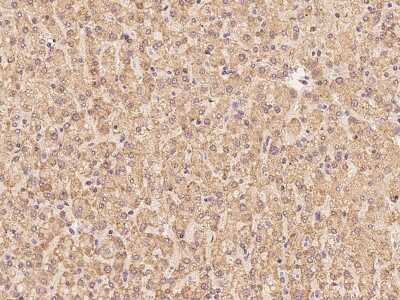 Immunohistochemistry-Paraffin: CLPX Antibody [NBP2-97804] - Immunochemical staining of human CLPX in human kidney with rabbit polyclonal antibody at 1:100 dilution, formalin-fixed paraffin embedded sections.