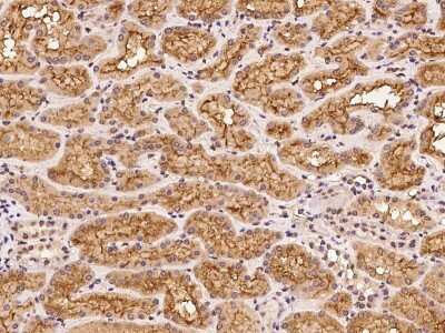 Immunohistochemistry-Paraffin: CLPX Antibody [NBP2-97804] - Immunochemical staining of human CLPX in human liver with rabbit polyclonal antibody at 1:100 dilution, formalin-fixed paraffin embedded sections.