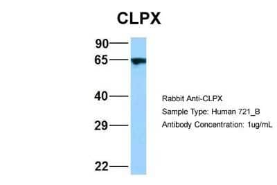 Western Blot: CLPX Antibody [NBP2-84698] - Host: Rabbit. Target Name: WT1. Sample Type: 721_B. Antibody Dilution: 1.0ug/mlCLPX is supported by BioGPS gene expression data to be expressed in 721_B