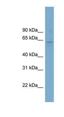 Western Blot: CLRN1 Antibody [NBP1-70501] - Titration: 0.2-1 ug/ml, Positive Control: OVCAR-3 cell lysate.
