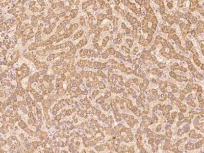 Immunohistochemistry-Paraffin: CLRN2 Antibody [NBP3-06331] - Immunochemical staining of human CLRN2 in human liver with rabbit polyclonal antibody at 1:100 dilution, formalin-fixed paraffin embedded sections.