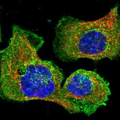 Immunocytochemistry/Immunofluorescence: CLTB Antibody [NBP2-55390] - Staining of human cell line A-431 shows localization to plasma membrane, cytosol & vesicles.