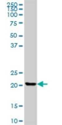 Western Blot: CLTB Antibody [H00001212-B01P] - Analysis of CLTB expression in human liver.