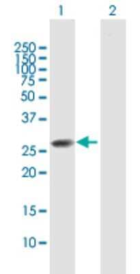 Western Blot: CLTB Antibody [H00001212-B01P] - Analysis of CLTB expression in transfected 293T cell line by CLTB polyclonal antibody.  Lane 1: CLTB transfected lysate(23.21 KDa). Lane 2: Non-transfected lysate.