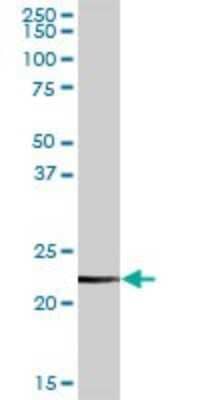 Western Blot: CLTB Antibody [H00001212-D01P] - Analysis of CLTB expression in human stomach.