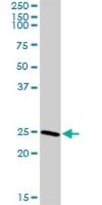 Western Blot: CLTB Antibody [H00001212-D01P] - Analysis of CLTB expression in mouse spleen.