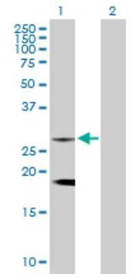 Western Blot: CLTB Antibody [H00001212-D01P] - Analysis of CLTB expression in transfected 293T cell line by CLTB rabbit polyclonal antibody.Lane 1: CLTB transfected lysate(23.20 KDa).Lane 2: Non-transfected lysate.