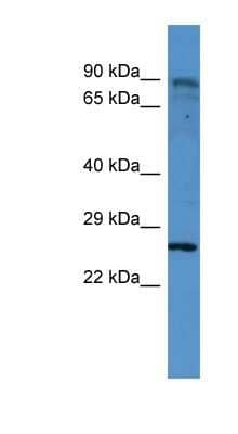 Western Blot: CLTB Antibody [NBP1-68945] - Jurkat cell lysate, concentration 0.2-1 ug/ml.