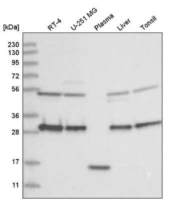 Western Blot: CLTB Antibody [NBP2-55390] - Western blot analysis in human cell line RT-4, human cell line U-251 MG, human plasma, human liver tissue and human tonsil tissue.