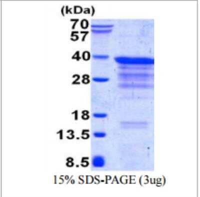 SDS-Page: CLTB Recombinant Protein [NBP1-98874]