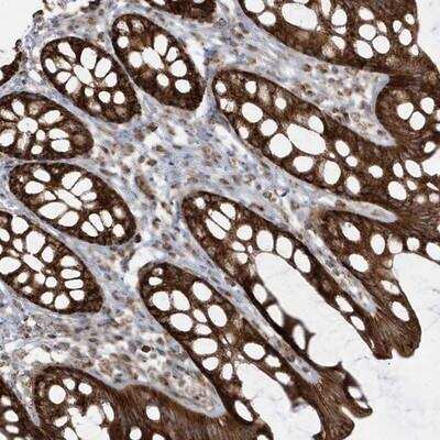 Immunohistochemistry-Paraffin: CLUAP1 Antibody [NBP1-84734] - Staining of human rectum shows strong cytoplasmic positivity in glandular cells.