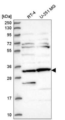 Western Blot: CLUAP1 Antibody [NBP2-58124] - Western blot analysis in human cell line RT-4 and human cell line U-251 MG.