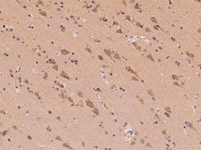 Immunohistochemistry-Paraffin: CLVS2 Antibody [NBP2-97429] - Immunochemical staining of human CLVS2 in human brain with rabbit polyclonal antibody at 1:100 dilution, formalin-fixed paraffin embedded sections.