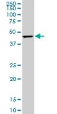 Western Blot: CMAS Antibody (5A2) [H00055907-M01] - CMAS monoclonal antibody (M01), clone 5A2. Analysis of CMAS expression in PC-12.