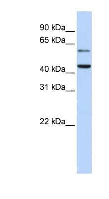 Western Blot: CMAS Antibody [NBP1-52910] - Fetal Brain lysate, concentration 0.2-1 ug/ml.