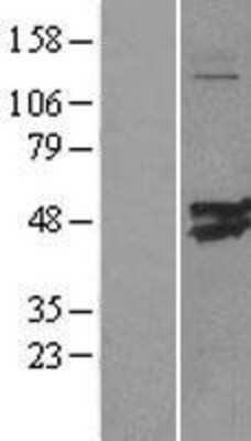 Western Blot: CMAS Overexpression Lysate (Adult Normal) [NBL1-09294] Left-Empty vector transfected control cell lysate (HEK293 cell lysate); Right -Over-expression Lysate for CMAS.