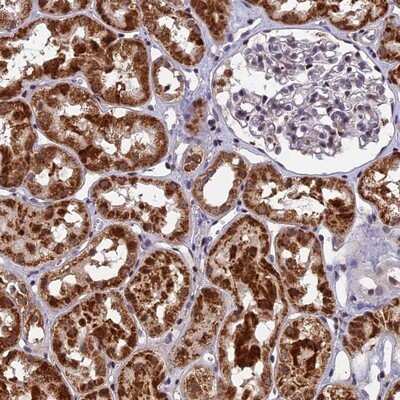 Immunohistochemistry-Paraffin CMC1 Antibody