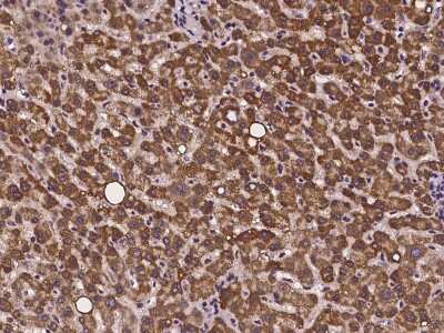 Immunohistochemistry-Paraffin CMC1 Antibody