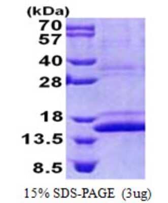 SDS-PAGE Recombinant Human CMC1 His Protein