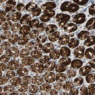 Immunohistochemistry-Paraffin CMC2 Antibody - BSA Free