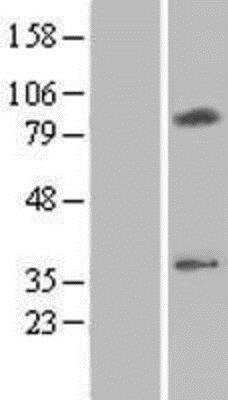 Western Blot: CMC2 Overexpression Lysate (Native) [NBP2-06681] - CMC2 Overexpression Lysate (Native) Left-Empty vector transfected control cell lysate (HEK293 cell lysate); Right -Over-expression Lysate for C16orf61.