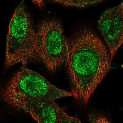 Immunocytochemistry/ Immunofluorescence CMIP Antibody