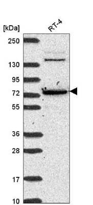 Western Blot CMIP Antibody