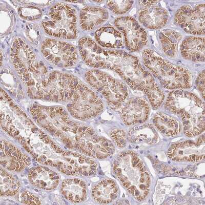 Immunohistochemistry-Paraffin: CMKLR1 Antibody [NBP2-13847] Staining of human kidney shows moderate cytoplasmic positivity in renal tubules.