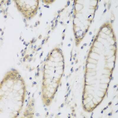 Immunohistochemistry-Paraffin CML2 Antibody - BSA Free