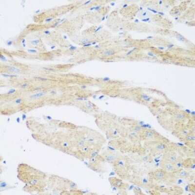 Immunohistochemistry-Paraffin CML2 Antibody - BSA Free