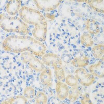 Immunohistochemistry-Paraffin: CML2 Antibody [NBP2-92803] - Paraffin-embedded rat kidney using CML2 .