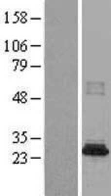 Western Blot: CML2 Overexpression Lysate (Adult Normal) [NBL1-13492] Left-Empty vector transfected control cell lysate (HEK293 cell lysate); Right -Over-expression Lysate for CML2.